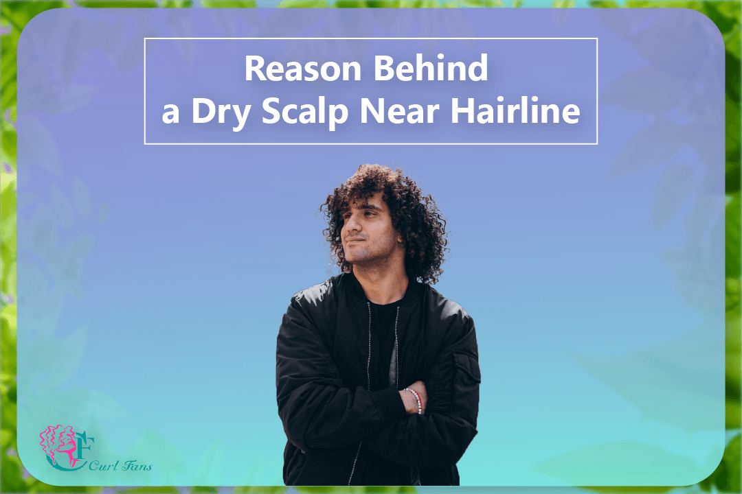 Reason Behind a Dry Scalp Near Hairline